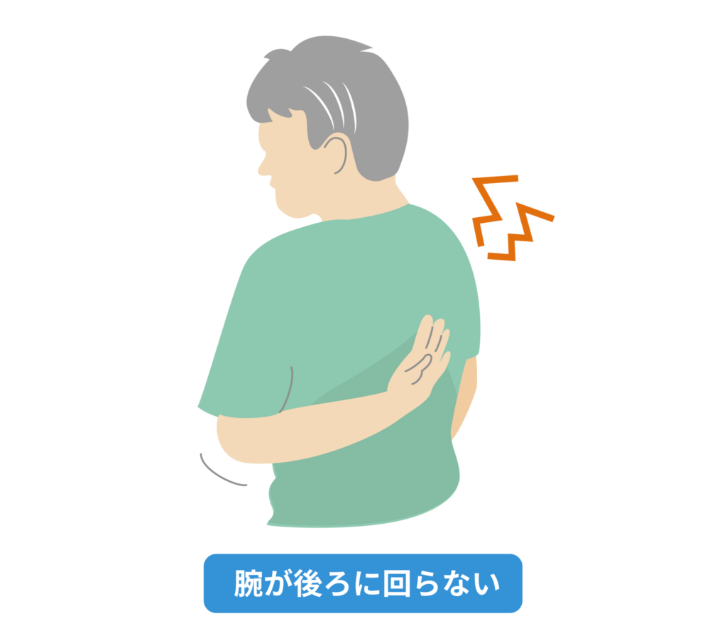 腕が後ろに回らない